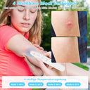 Soarfly - Mosquito Bite Heat Pen for Quick Relief from Itching & Swelling
