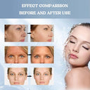 Eelhoe - Bio-Collagen Face Mask for Lifting, Firming & Deep Moisturizing, 4 PCS