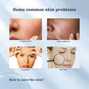 Eelhoe - Bio-Collagen Face Mask for Lifting, Firming & Deep Moisturizing, 4 PCS