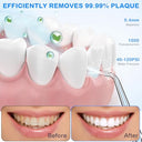 Koovon - Cordless Water Dental Flosser with 4 Modes, 5 Jet Tips & Travel Case