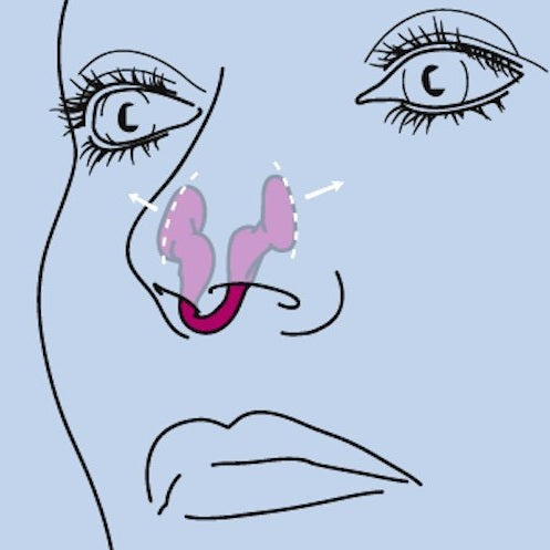AIRMAX® - Sport Nasal Dilator For Better Breathing During Sports - Size S