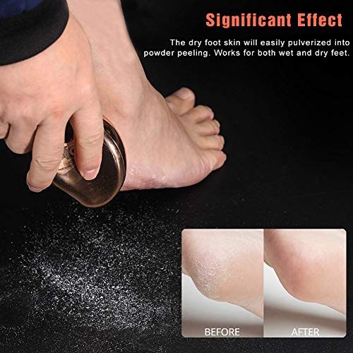 Bezox - Glass Foot File Callus Remover, Portable Crystal Pedicure Scrubber, Golden Finish