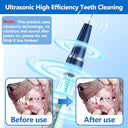 Ni-Shen - Dog Teeth Cleaning Kit, Tartar & Plaque Remover for Pets, Easy to Use